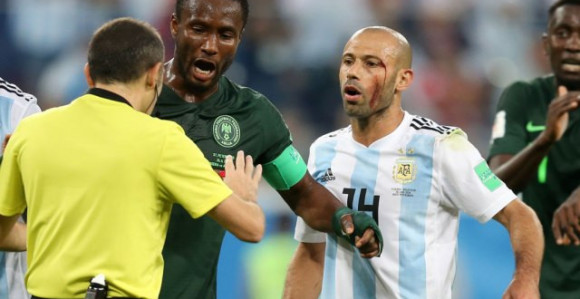 Mikel: Argentinci igrali rukomet, a Čakir gledao...!