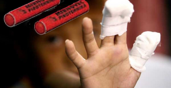 Petarde nisu igračke!