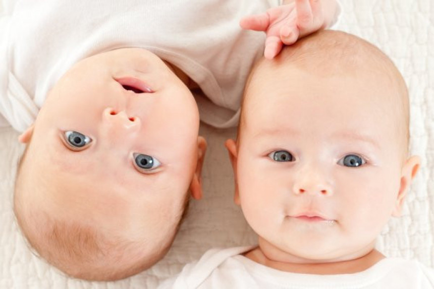 Drugi zabilježeni slučaj poluidentičnih blizanaca u istoriji