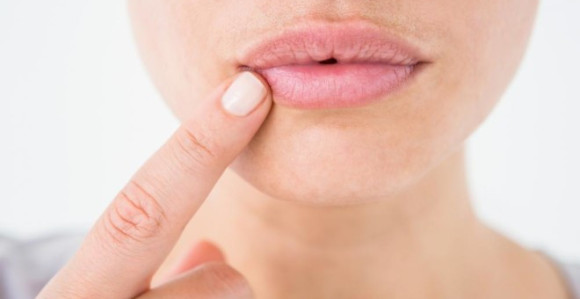 Šta otkrivaju ispucale usne?