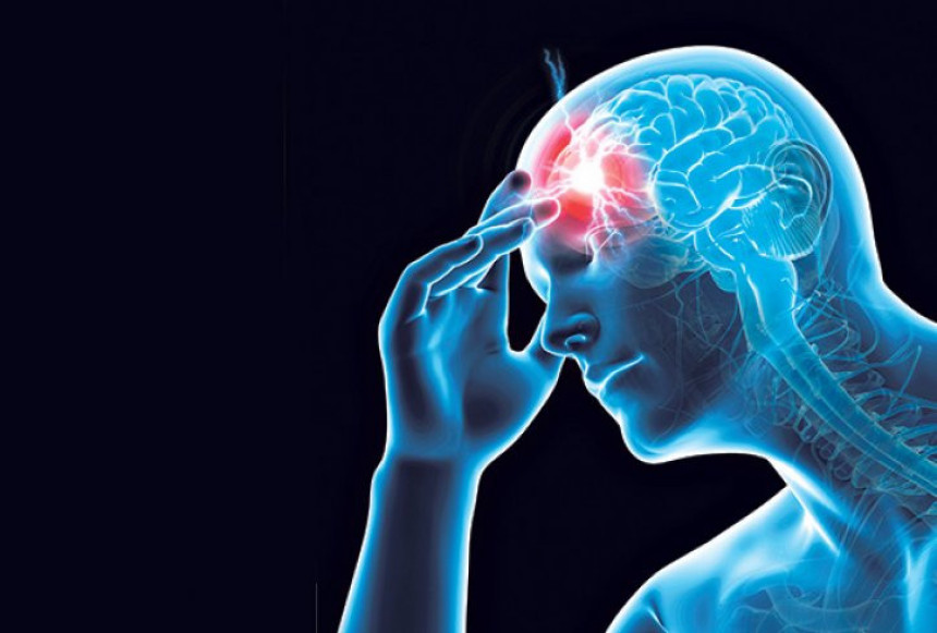 Prve simptome moždanog udara morate da znate