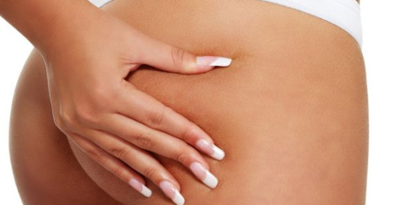 Mitovi o celulitu koje morate da zaboravite