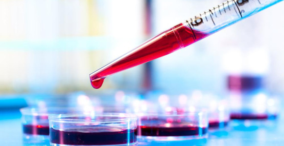 Analiza krvi umjesto biopsije