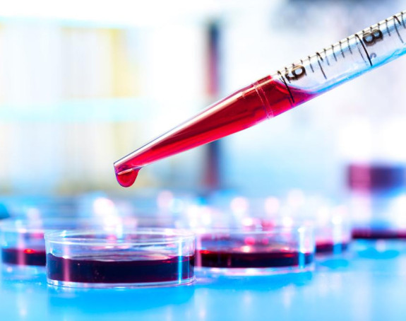 Analiza krvi umjesto biopsije