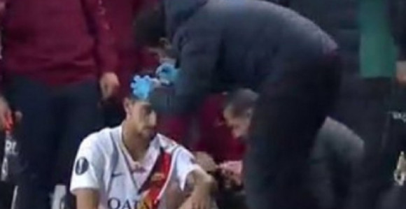 Džekinom saigraču navijači razbili glavu