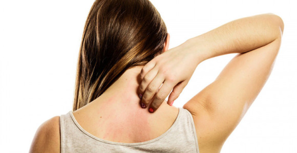 1.000 ljudi u BiH zaraženo šugom