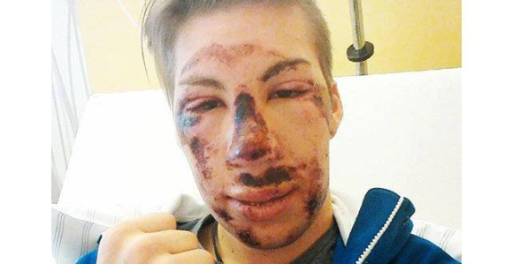 Видео: Језиво! Тежак пад аустријског скијаша и узнемирујућа слика из болнице!