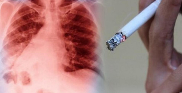 Kako da sačuvate svoja pluća