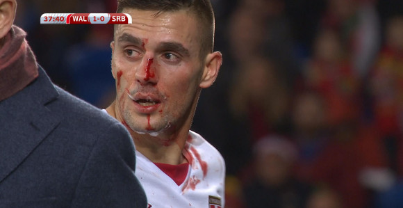 SP - Tadić: Žao mi je što Tejlor neće igrati!