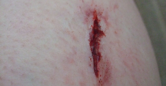 Nožem ubio suprugu, pa ranio sebe