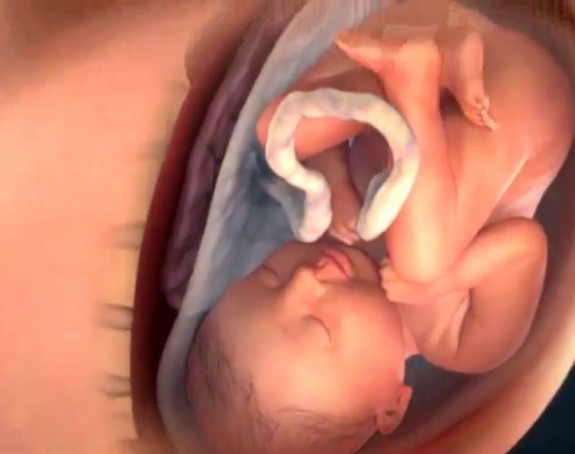 Bebe plaču i u stomaku