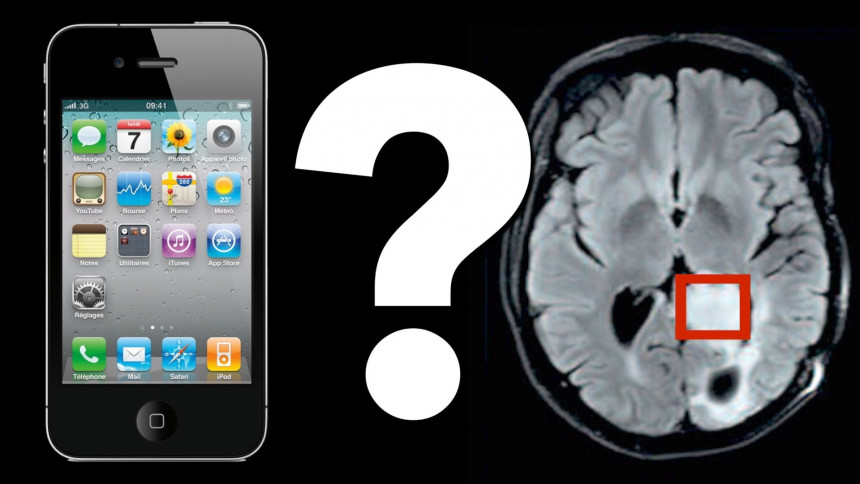 Мобилни телефони изазивају рак?