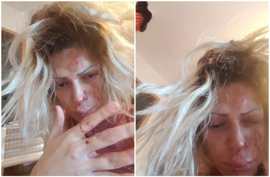 Pjevačica brutalno pretučena? 