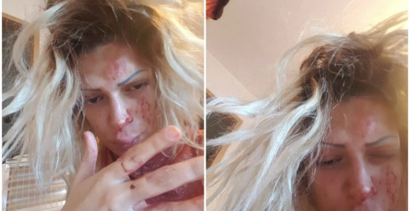 Pjevačica brutalno pretučena? 