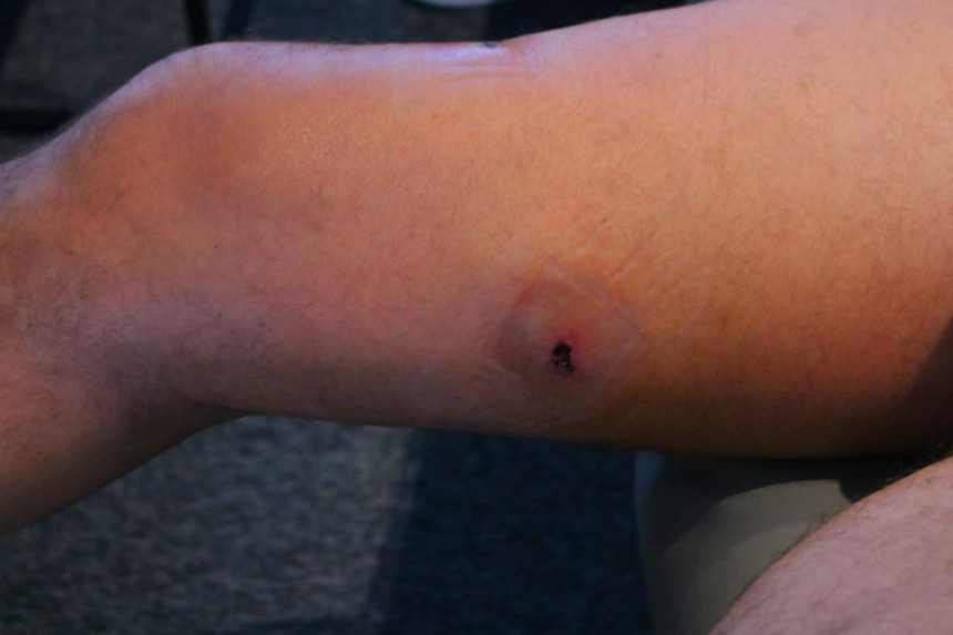 Огласио се Мамић и показао рану од метка!