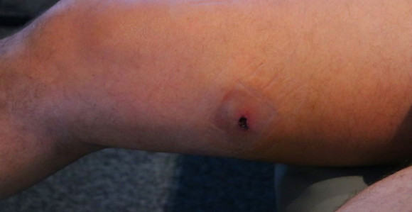 Огласио се Мамић и показао рану од метка!