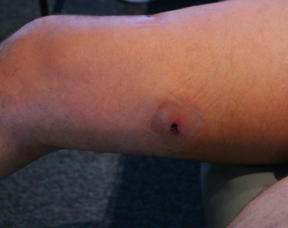 Oglasio se Mamić i pokazao ranu od metka!