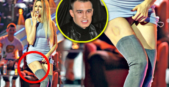 Rada u modricama: Voli da me grize!