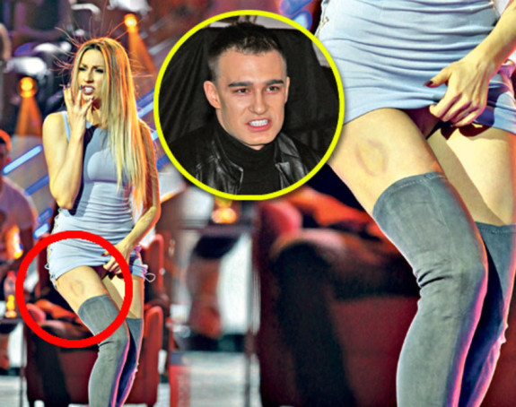 Rada u modricama: Voli da me grize!