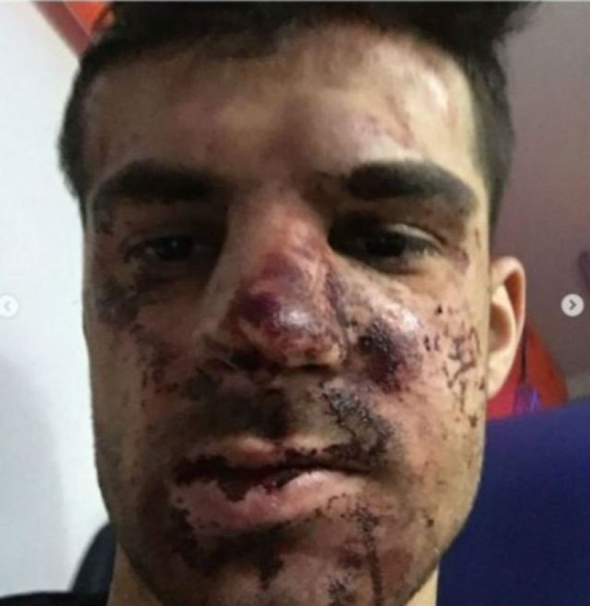 Nemoj nikad u Rusiji da se svađaš oko parkinga!