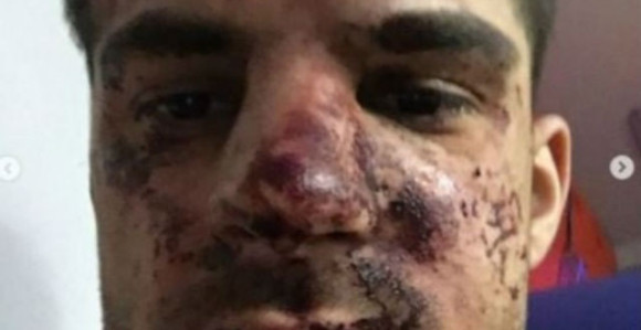 Nemoj nikad u Rusiji da se svađaš oko parkinga!