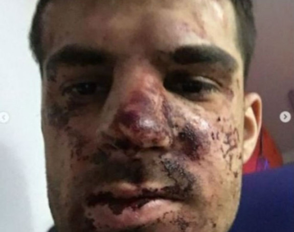 Nemoj nikad u Rusiji da se svađaš oko parkinga!